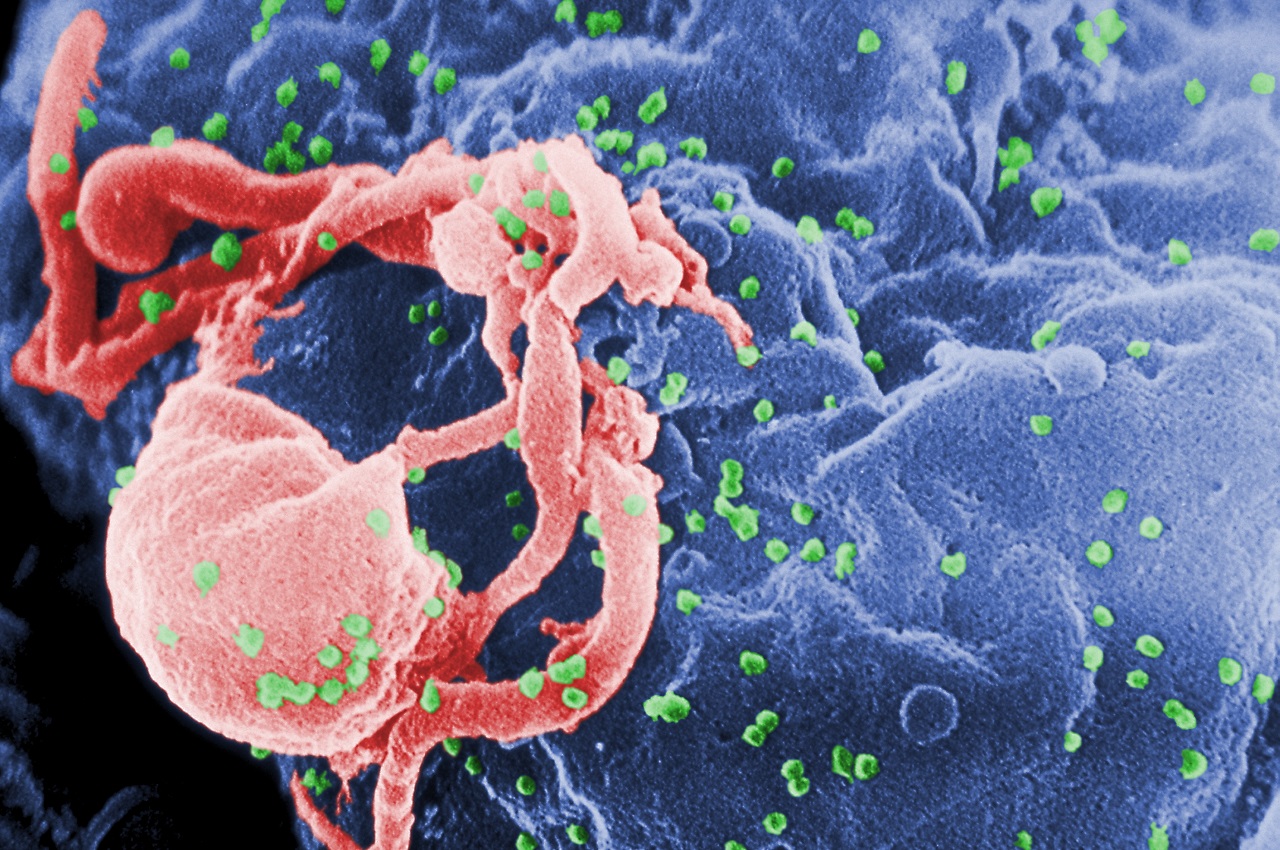 Már pontosan lehet tudni, hogy melyik afrikai városban kezdett először terjedni a HIV