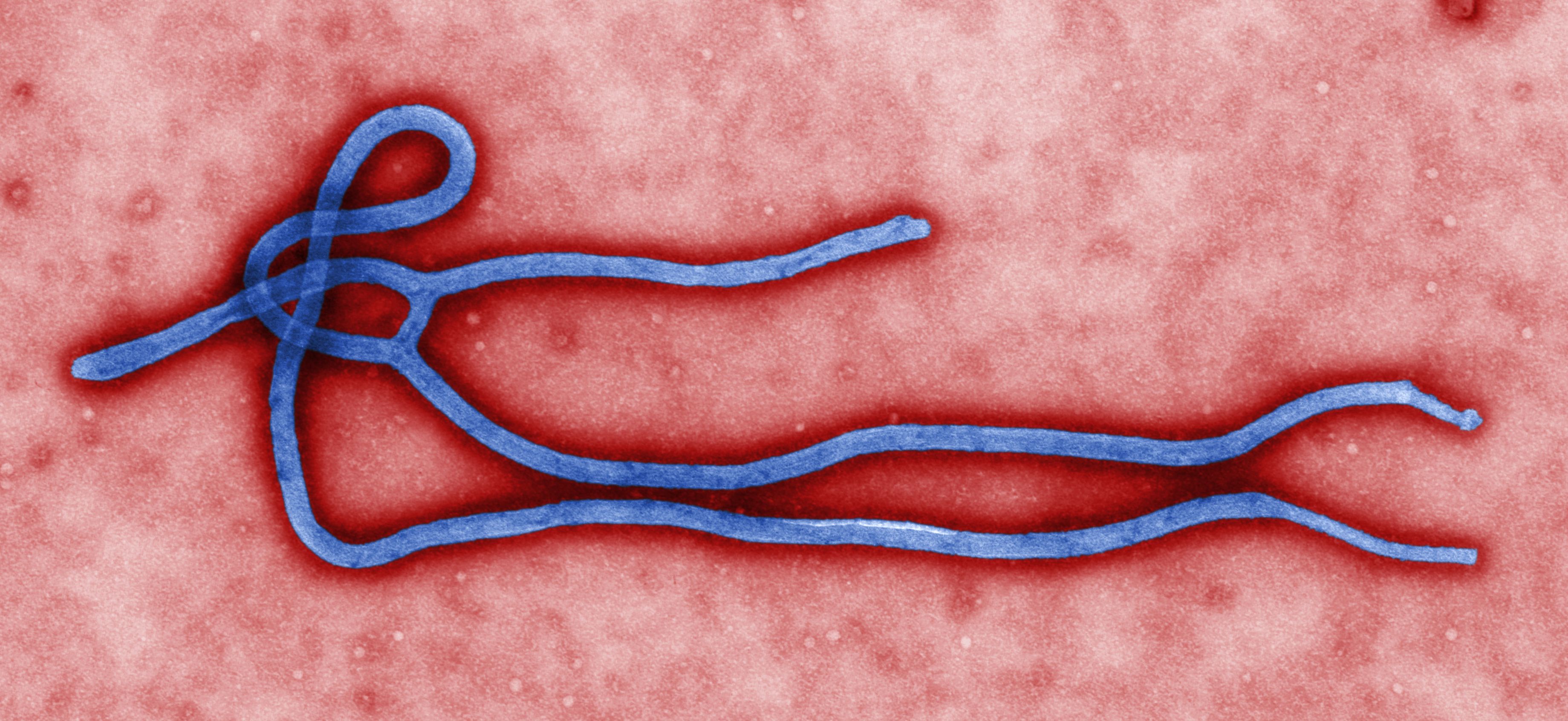 A WHO-nak van végre terve az afrikai ebola járvány megfékezésére