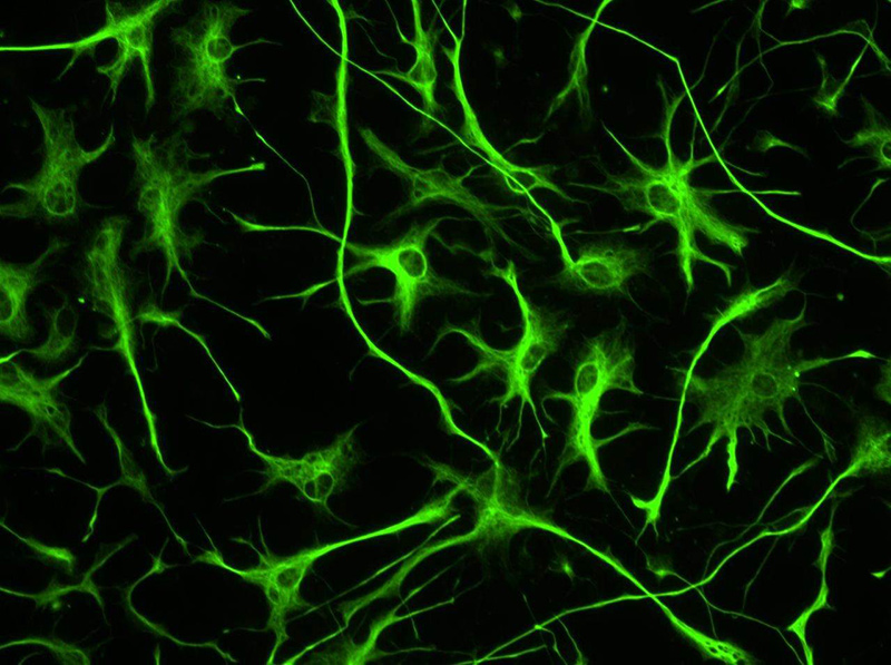 Hogyan tanulnak a tenyésztett idegsejtek a petri csészében?