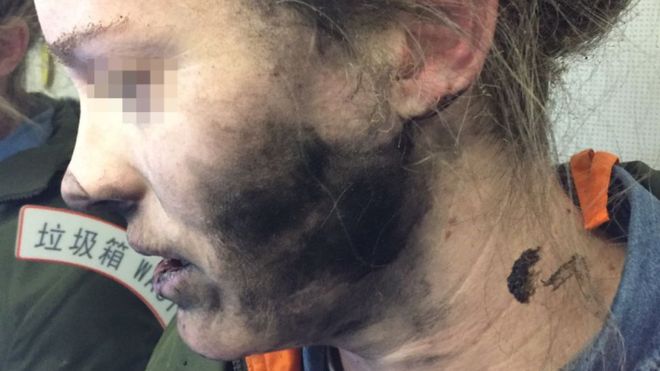 Repülés közben robbant fel egy ausztrál nő fejhallgatója