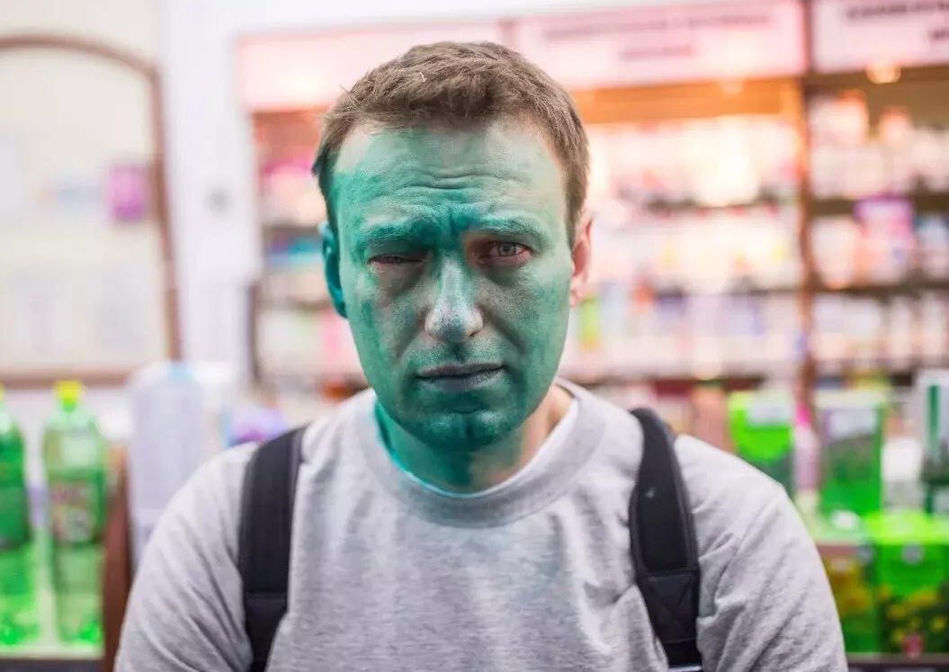 Egyik szemére maradandóan megvakulhat Navalnij, Putyin legismertebb ellenfele