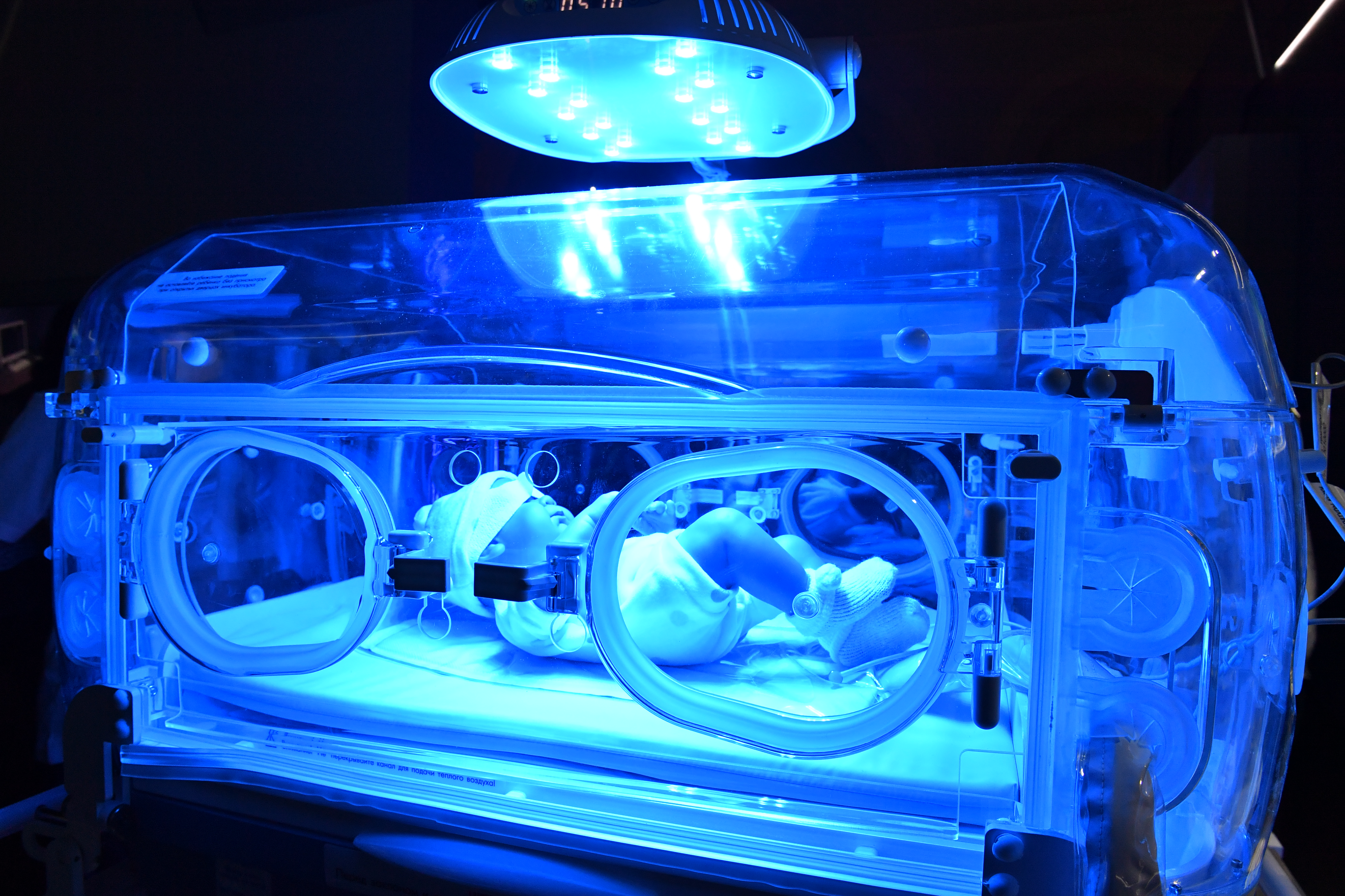 Szívbeteg babát hagytak egy nyugat-magyarországi kórházban