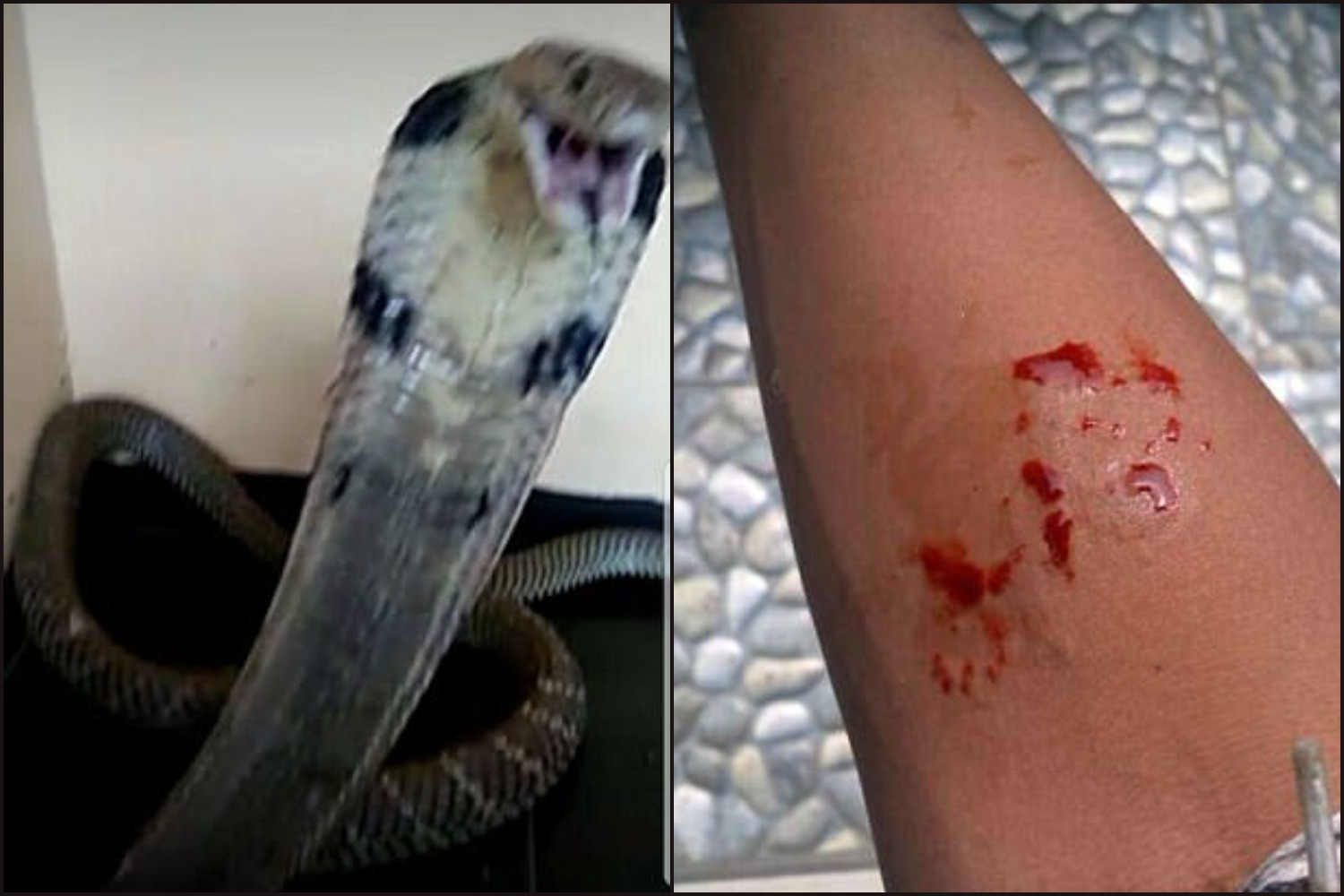 Kiposztolta a WhatsAppra, hogy megmarta a saját kobrája, fél nappal később belehalt