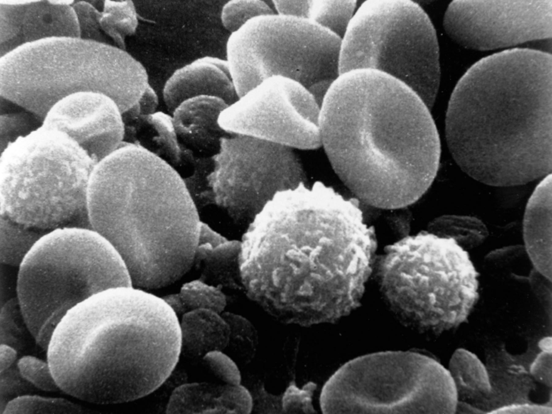 Vérsejtek elektronmikroszkóp alatt