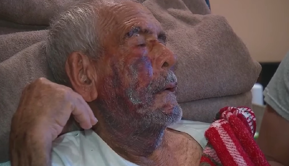 Menj vissza Mexikóba, kiáltotta egy nő a 91 éves férfinak, aztán betontömböt vágott az arcába