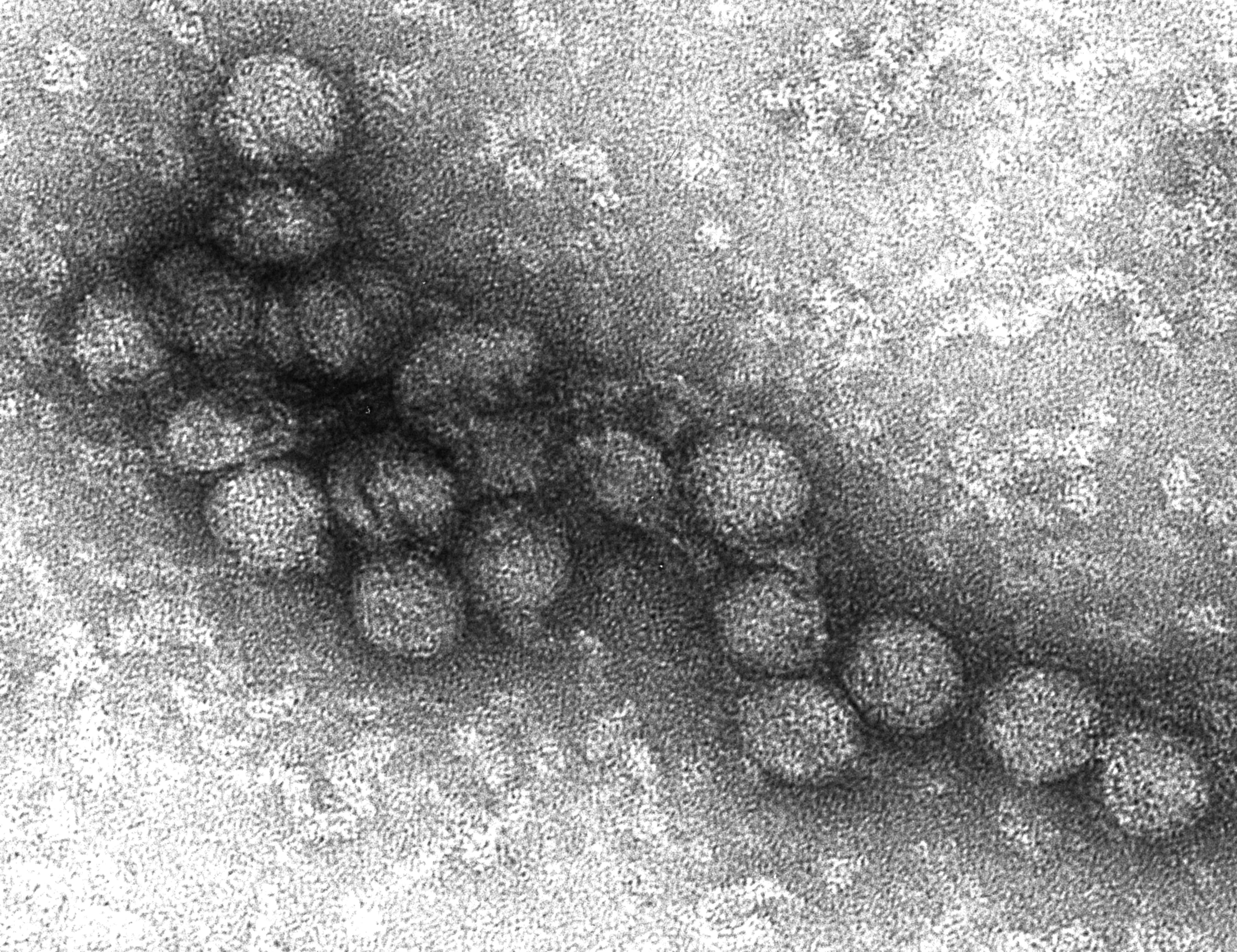 Nyugat-nílusi vírus elektronmikroszkópos felvétele