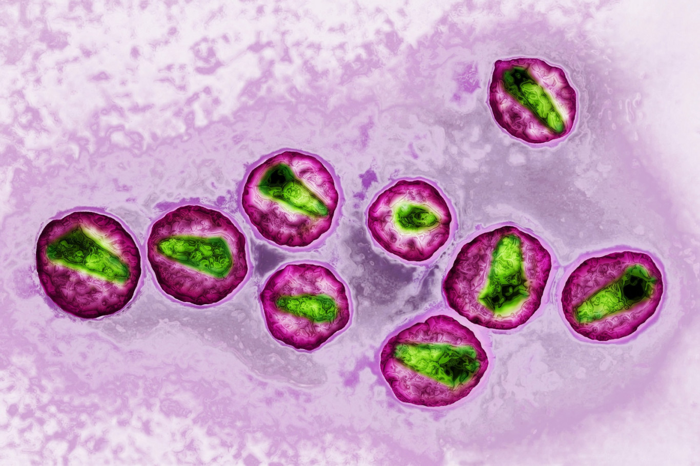 Melbourne-i kutatók rájöttek, hogy calogatható elő a HIV vírus a fehérvérsejtekből, ez pedig óriási áttörés