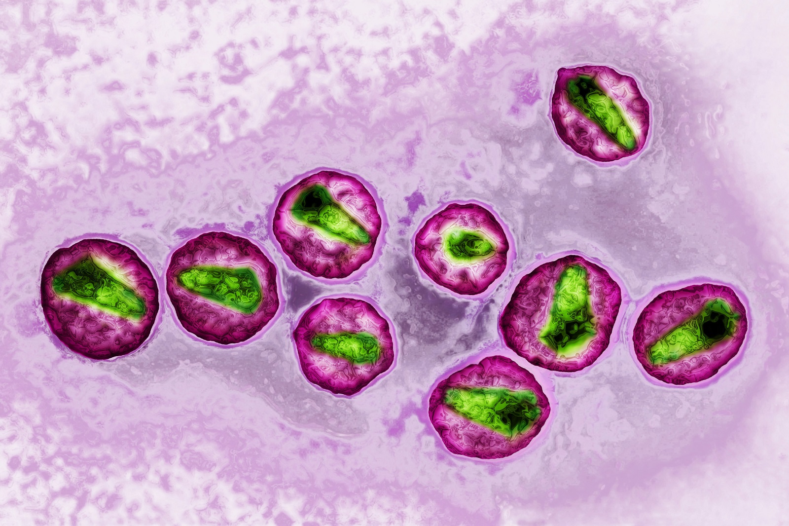 A HIV különösen fertőző, új variánsát fedezték fel Hollandiában