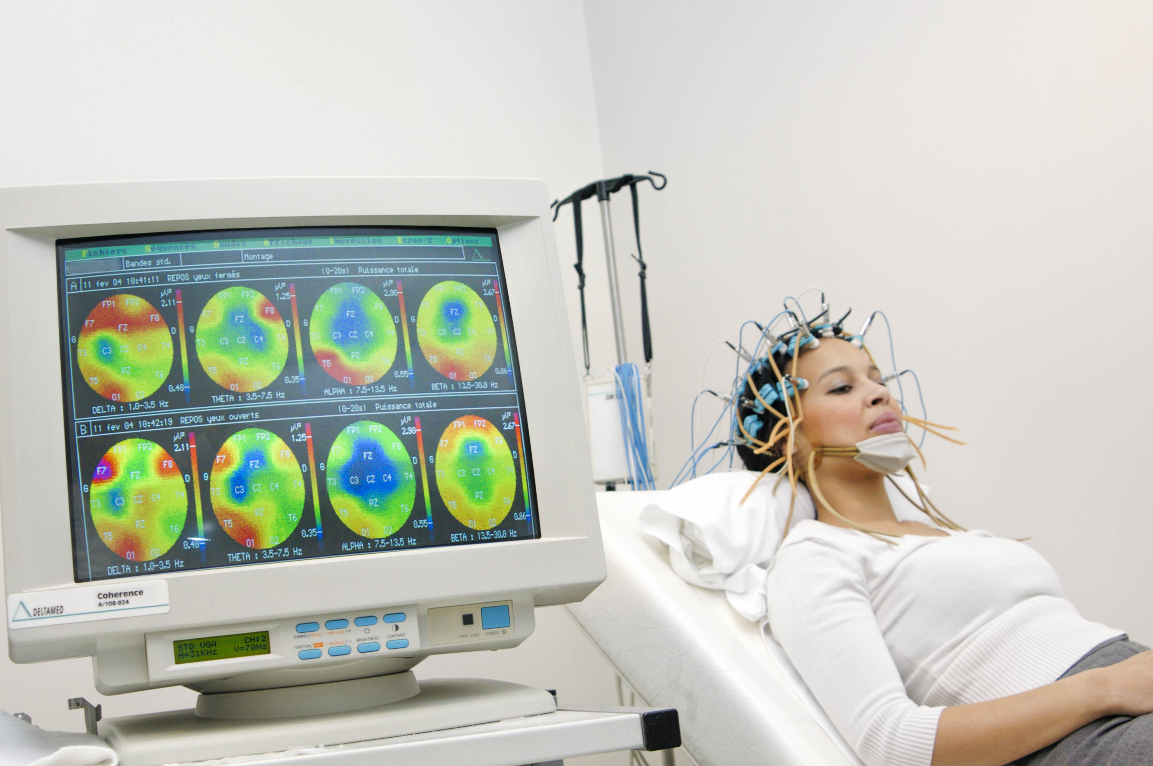 Elektroenkefalográfos (EEG) vizsgálat