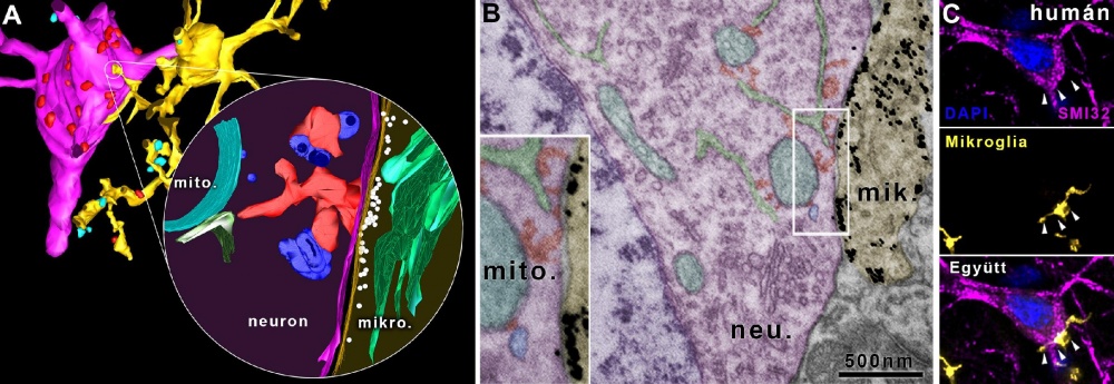 A: Fénymikroszkópos (balra) és elektron-tomográfiás (jobbra, kinagyított rész) felvétel alapján készült 3D-rekonstrukció mutatja az újonnan felfedezett mikroglia (okker) – neuron (magenta) szomatikus kapcsolat szerkezetét B: Elektronmikroszkópos felvételen a mitokondriumok (türkiz), a mitokondrium-kapcsolt membrán (zöld), a horgonyzóstruktúrák (piros) és a vezikulák (kék)  C: Az újonnan azonosított kapcsolattípus az emberi agyban