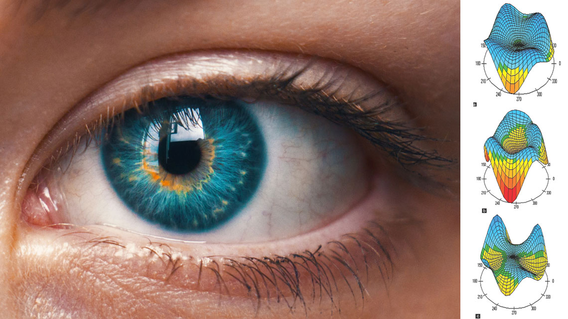 mit jelent a látás 25 sejtes gyengénlátó emberek számára