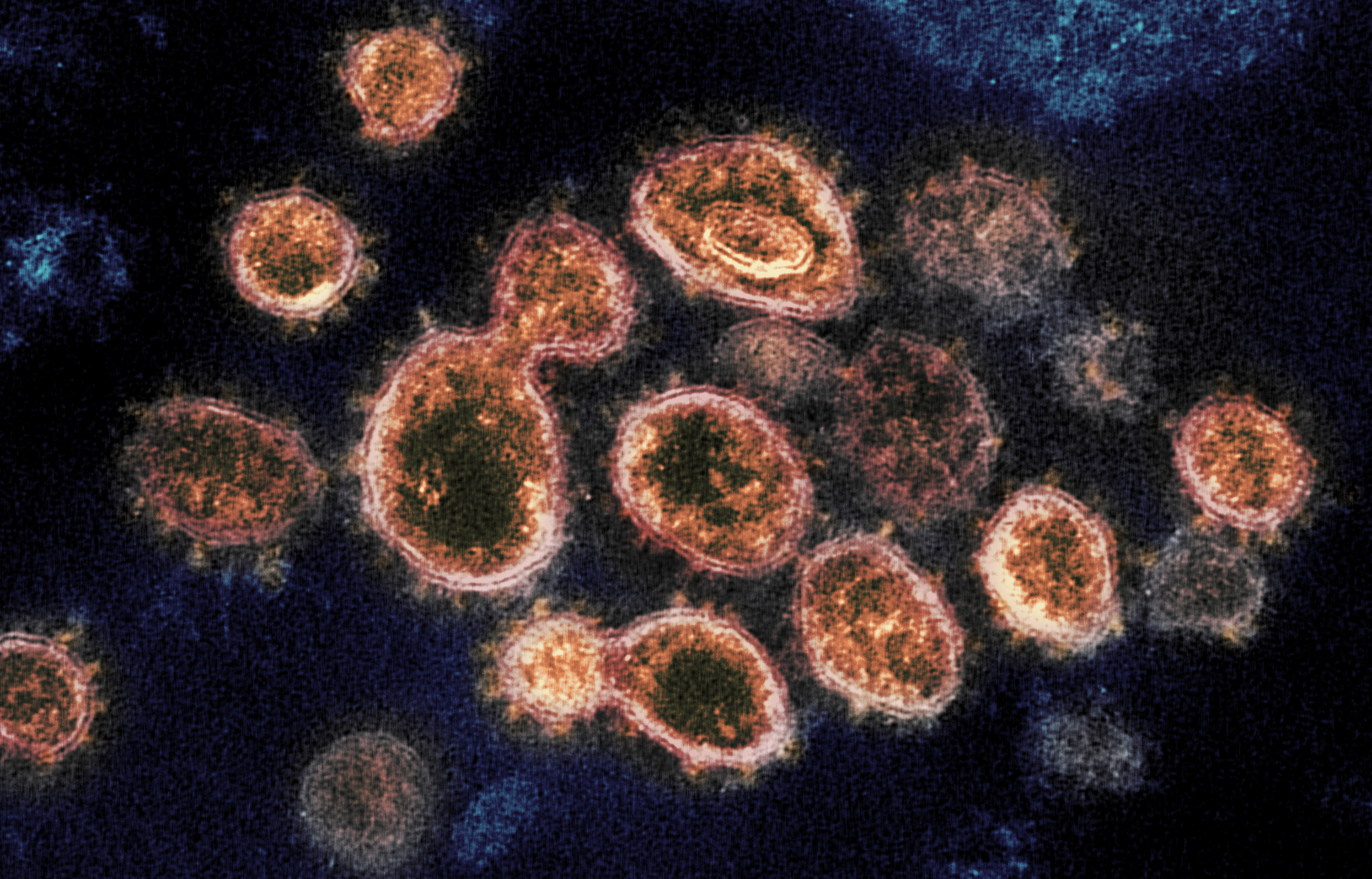 Meglepő mutációt fedeztek fel egy Indiában izolált vírusban