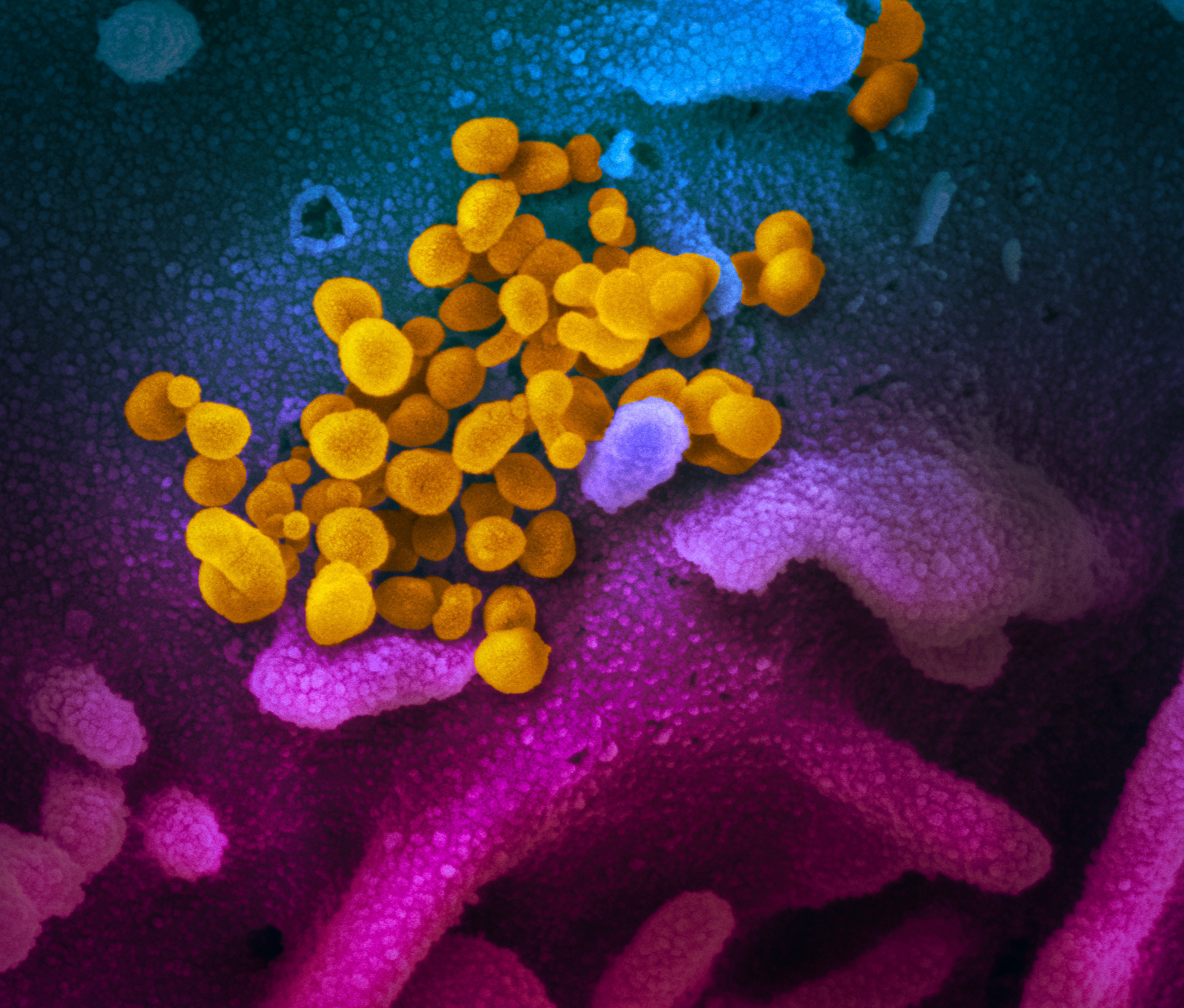 Mit tudtunk meg az elmúlt hónapban a koronavírusról, és mi az, amit nagyon szeretnénk megtudni?