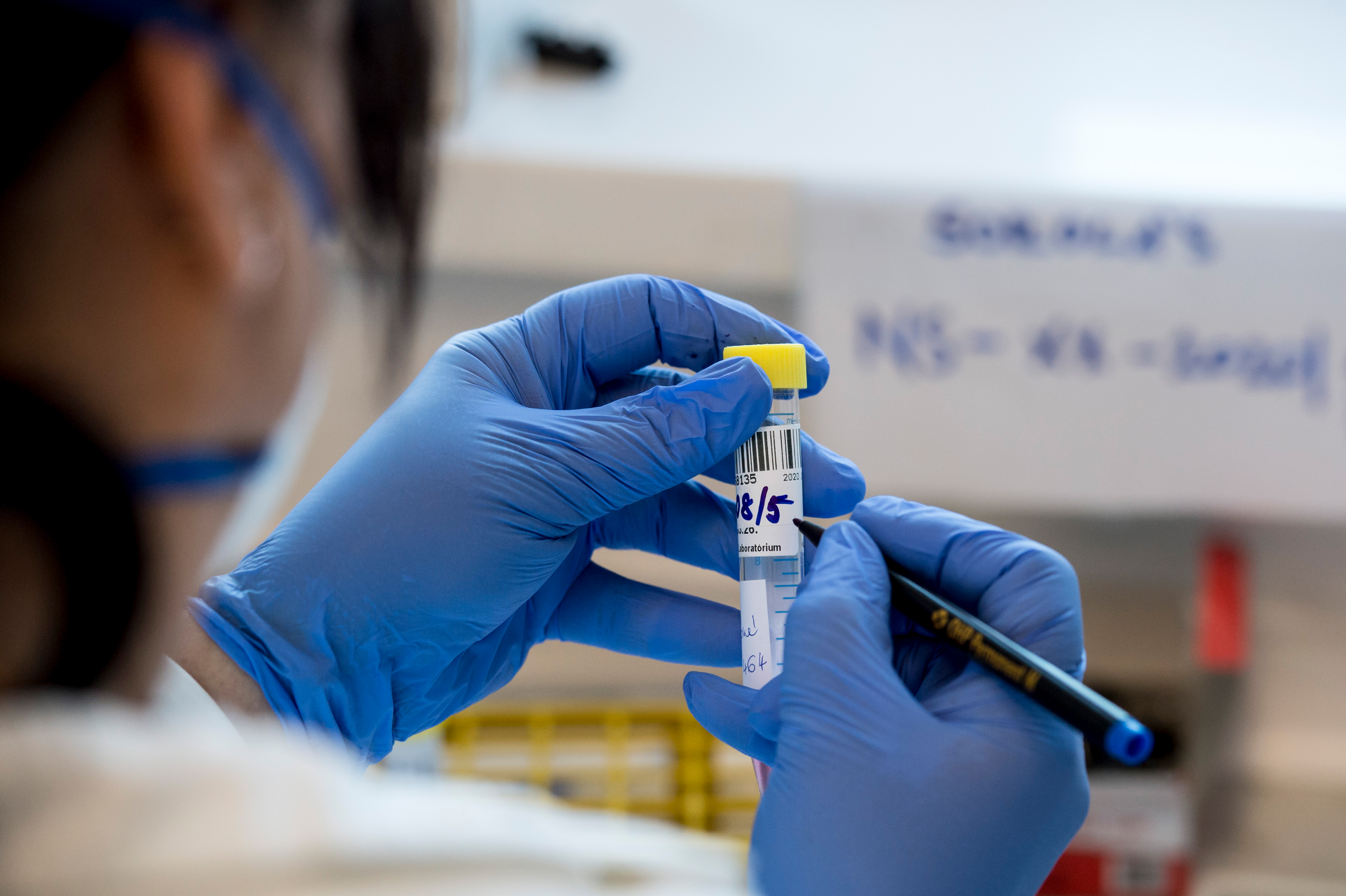 17 000 fős reprezentatív koronavírus-szűrővizsgálatot végez a Semmelweiss Egyetem vezetésével négy hazai orvosképző