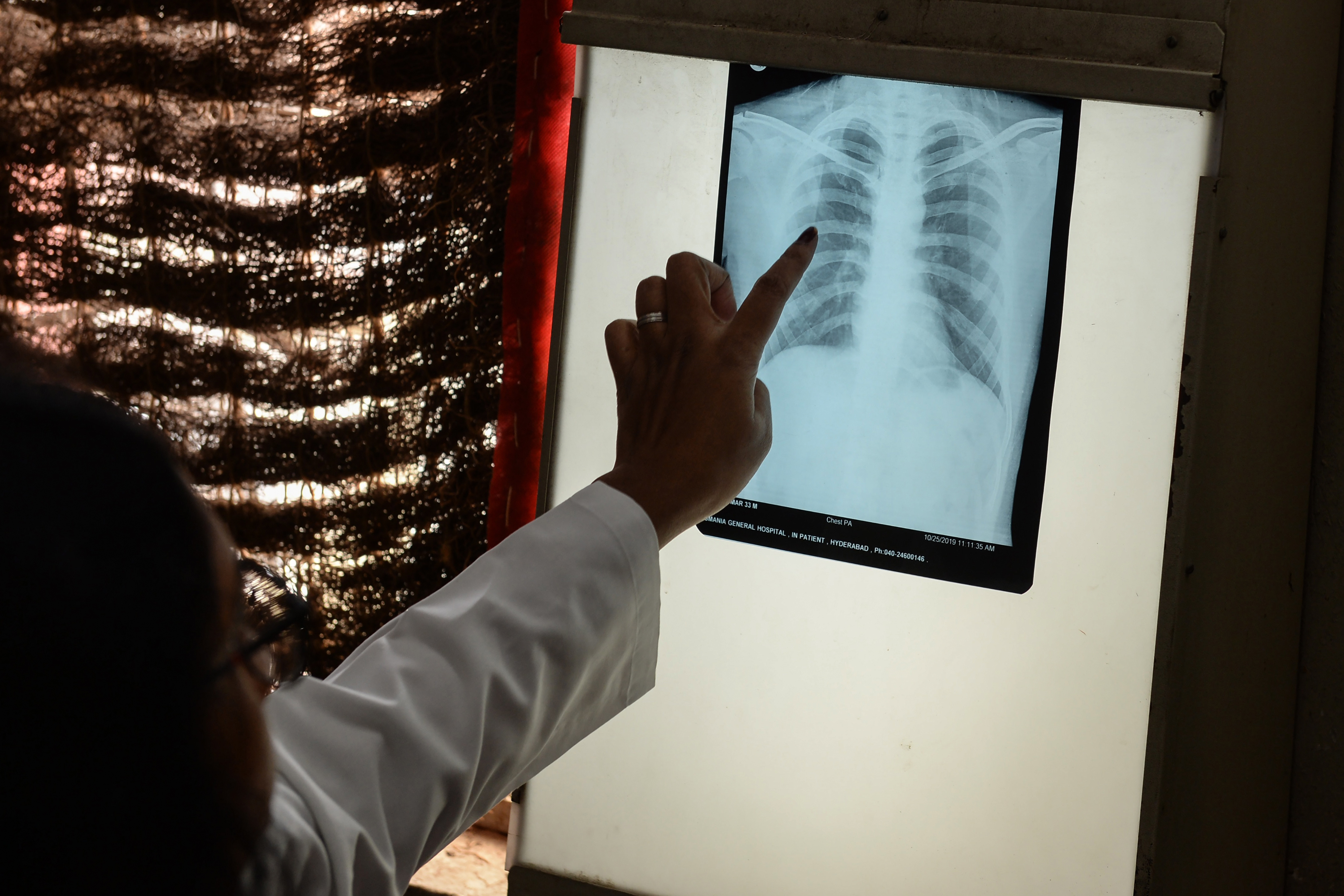 2019 októberében egy indiai tüdőkonferencián kutatók azt állították, hogy közel járnak a sikeres tbc-vakcina fejlesztéséhez