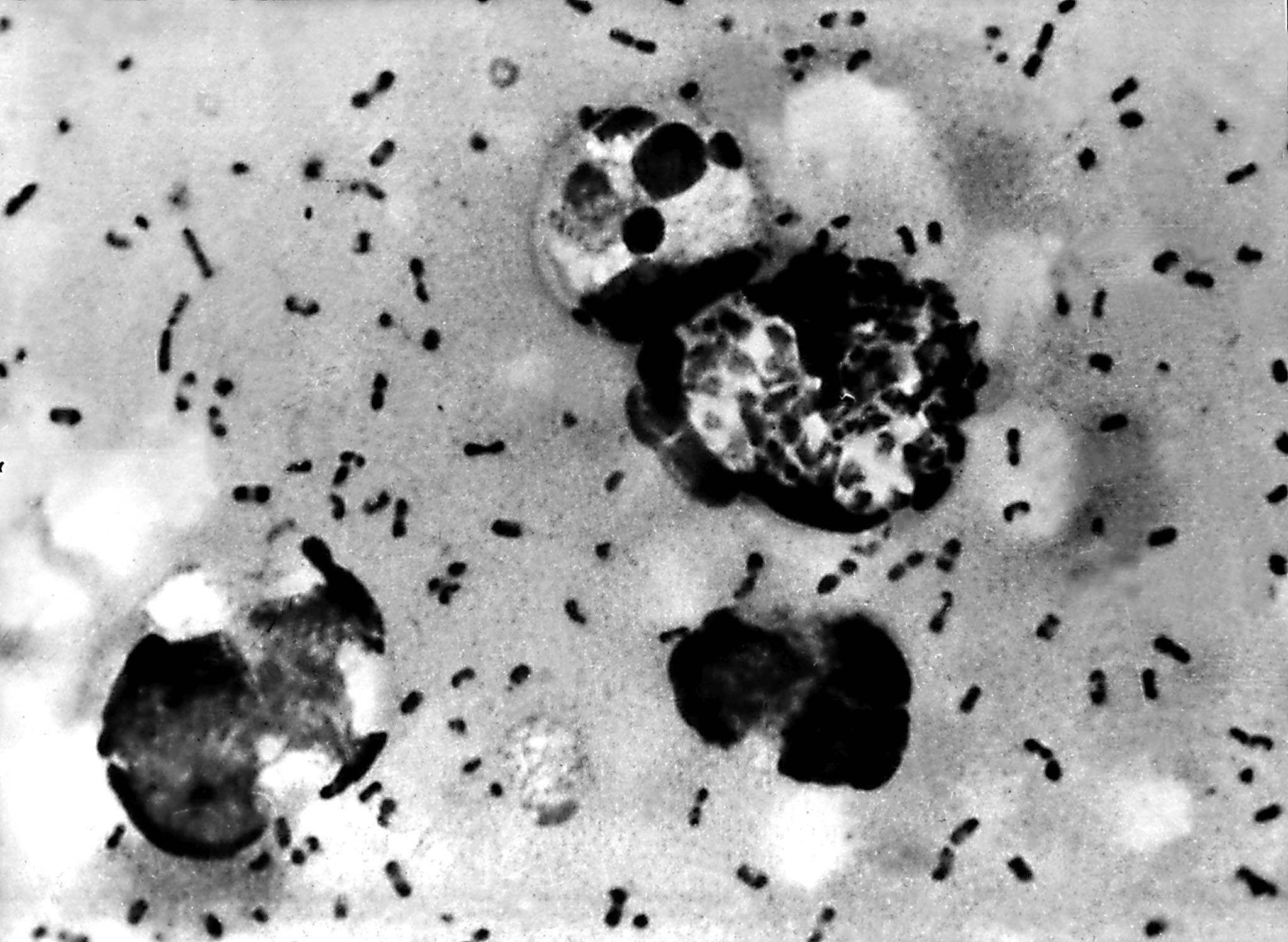 A Yersinia pestis, korábbi nevén Pasteurella pestis baktérium elektronmikroszkópos képe