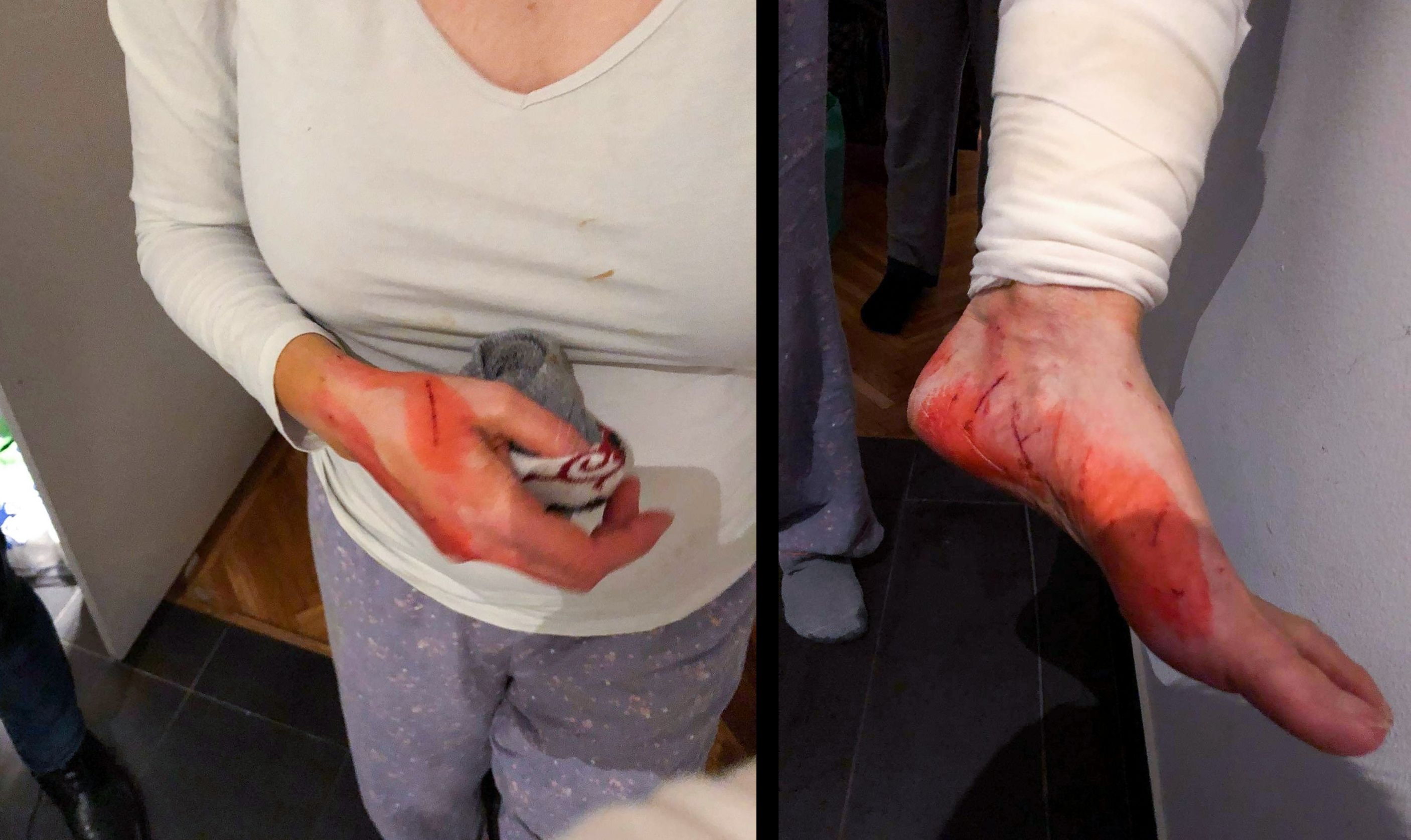 Macskatámadás Budapesten: kórházba küldte gazdáját Lizi