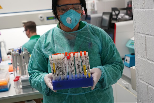 Magyar diagnosztikai labor dobott piacra egy tesztet, ami kimutatja, hogy a betegséged koronavírus vagy influenza