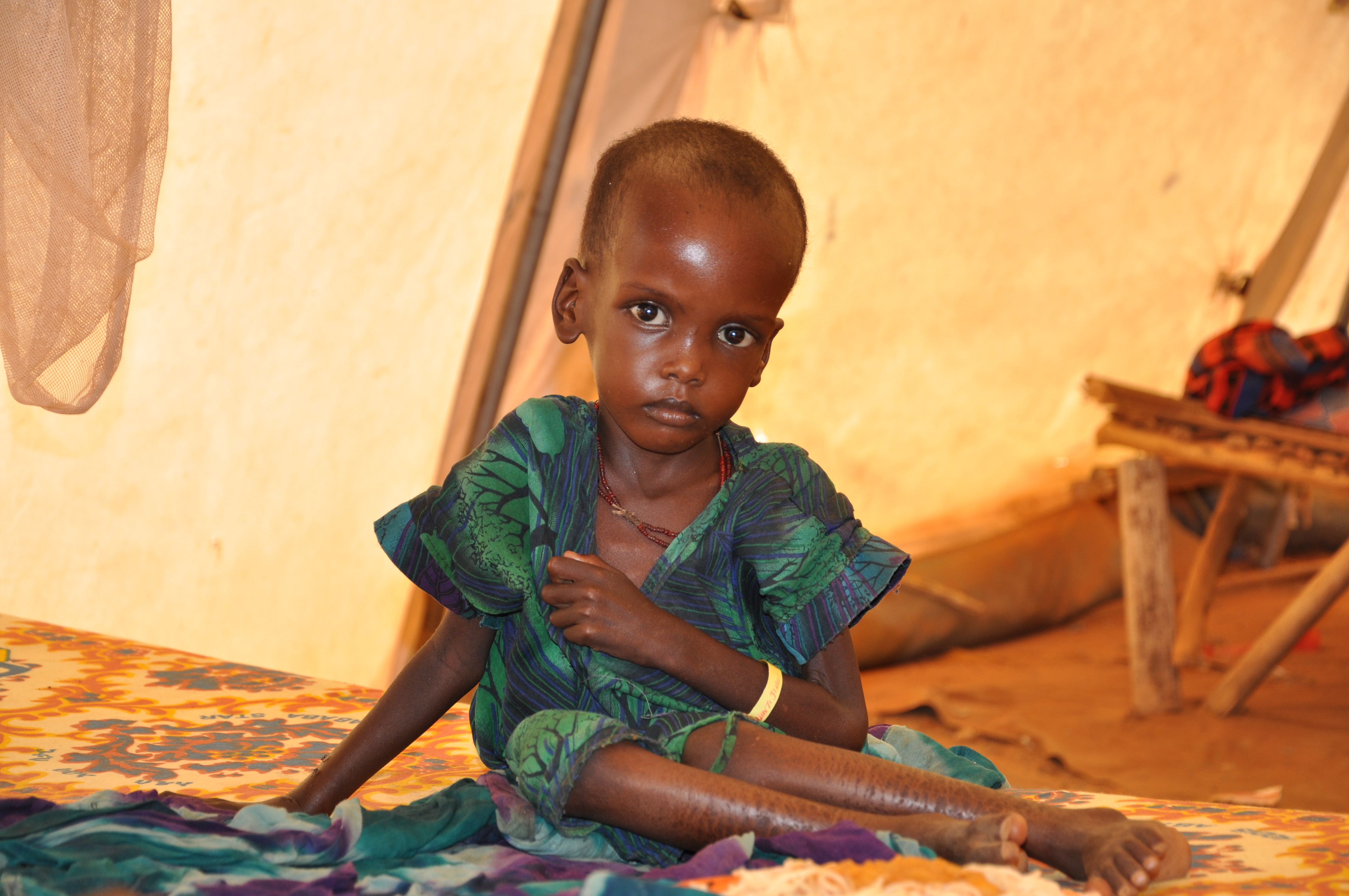 Alultáplált gyerek 2011-ben az etióp-szomáliai határon. Hatástalan, mert túl sokat láttuk?
