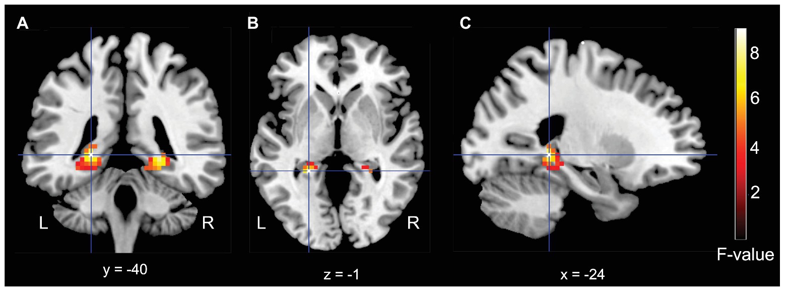 Az fMRI-vizsgálatokon a hátsó hippokampusz-régiókban erős kölcsönhatást mutattak ki két vizsgált tényező – a megismerés (ismerős kontra nem ismerős) és az elrendezés (önálló objektum kontra pár) – között.