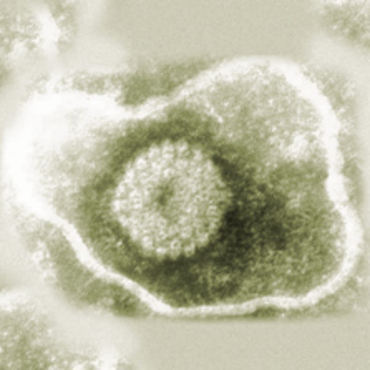 Az EHV-1 vírus elektronmikroszkópos portréja