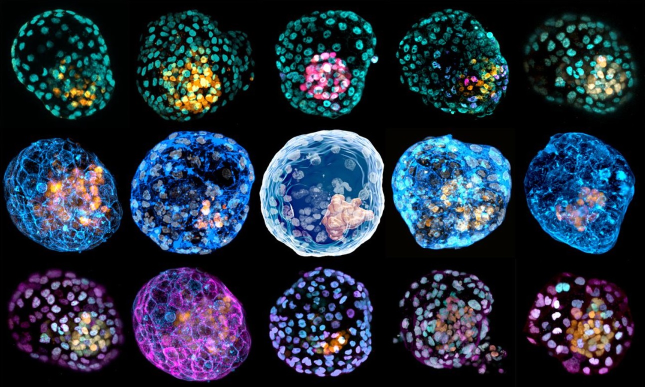 Először hoztak létre kutatók az emberi fejlődés legelső szakaszait szimuláló mesterséges embriókat