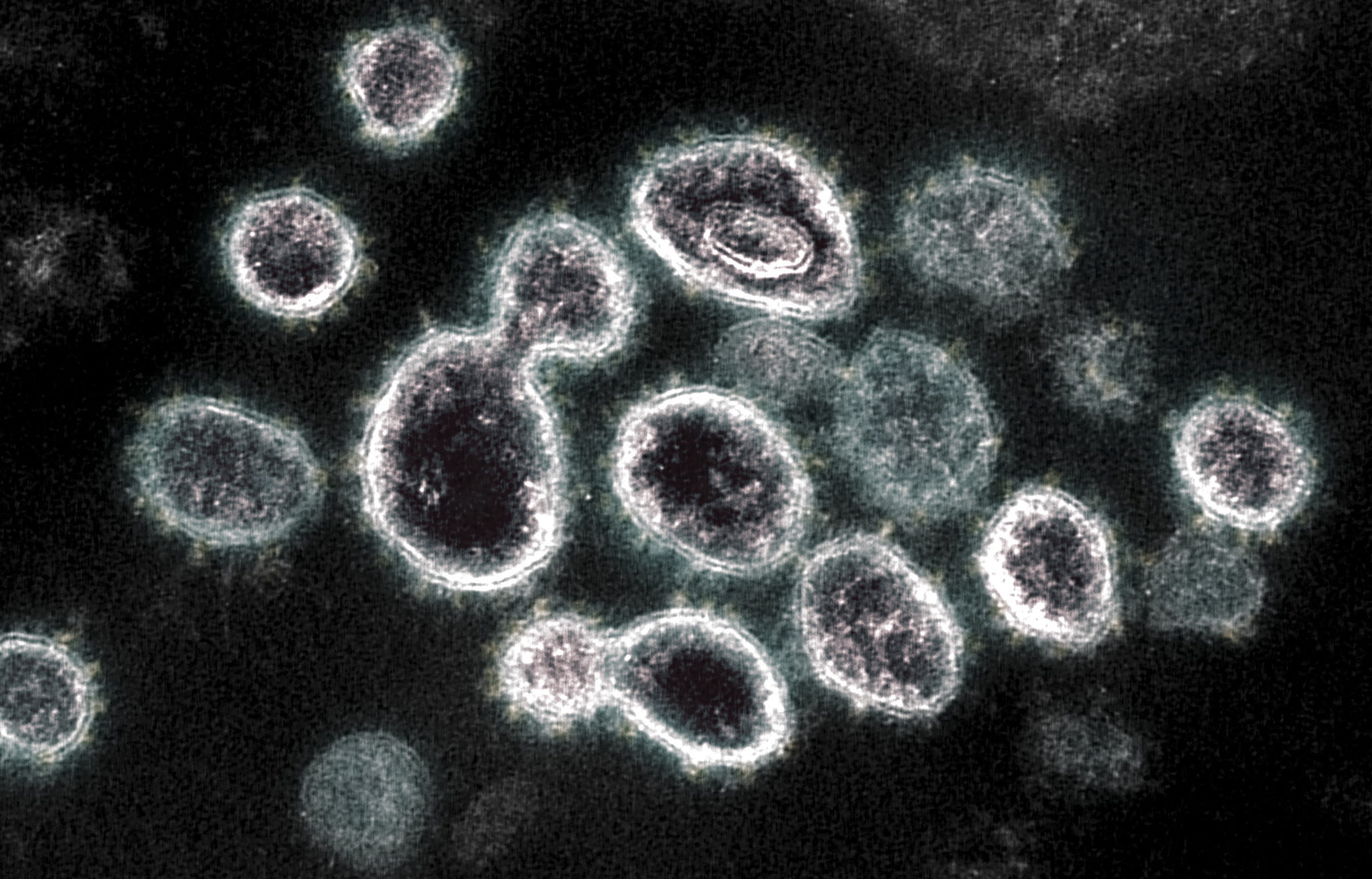 Megfertőzött sejtekből előbukkanó koronavírusok elektronmikroszkóp alatt.
