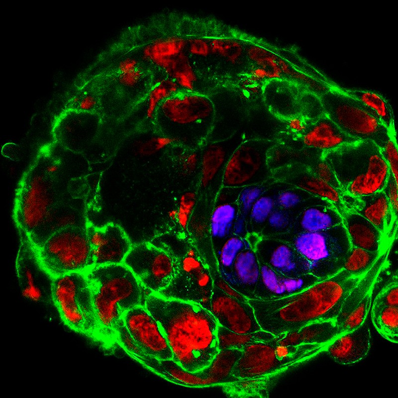Laborban növesztett emberi embrió a megtermékenyítés utáni 10. napon – lilával azok a sejtek, amelyekből később a magzat kifejlődik