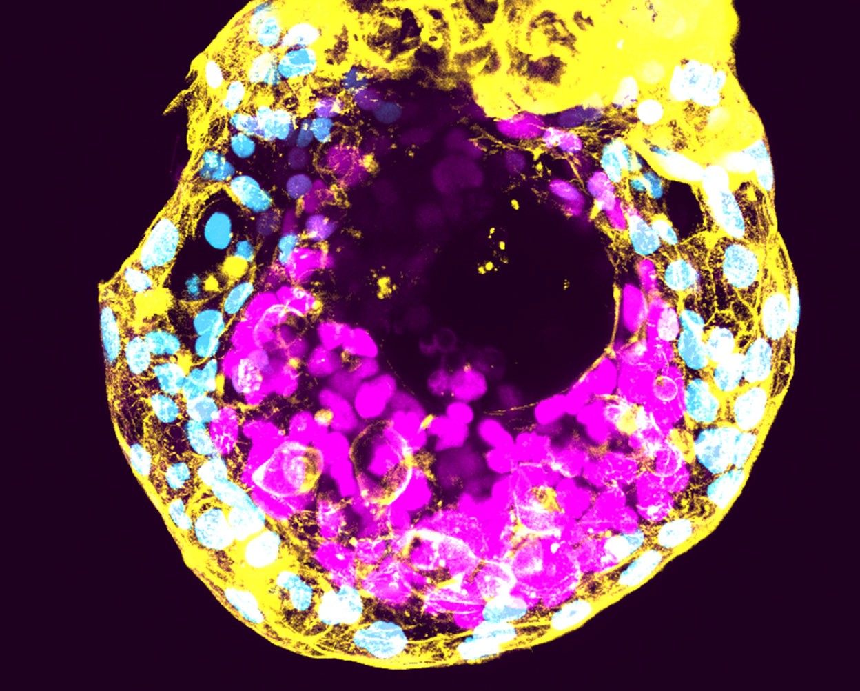 Laborban növesztett emberi embrió a megtermékenyítés utáni 12. napon