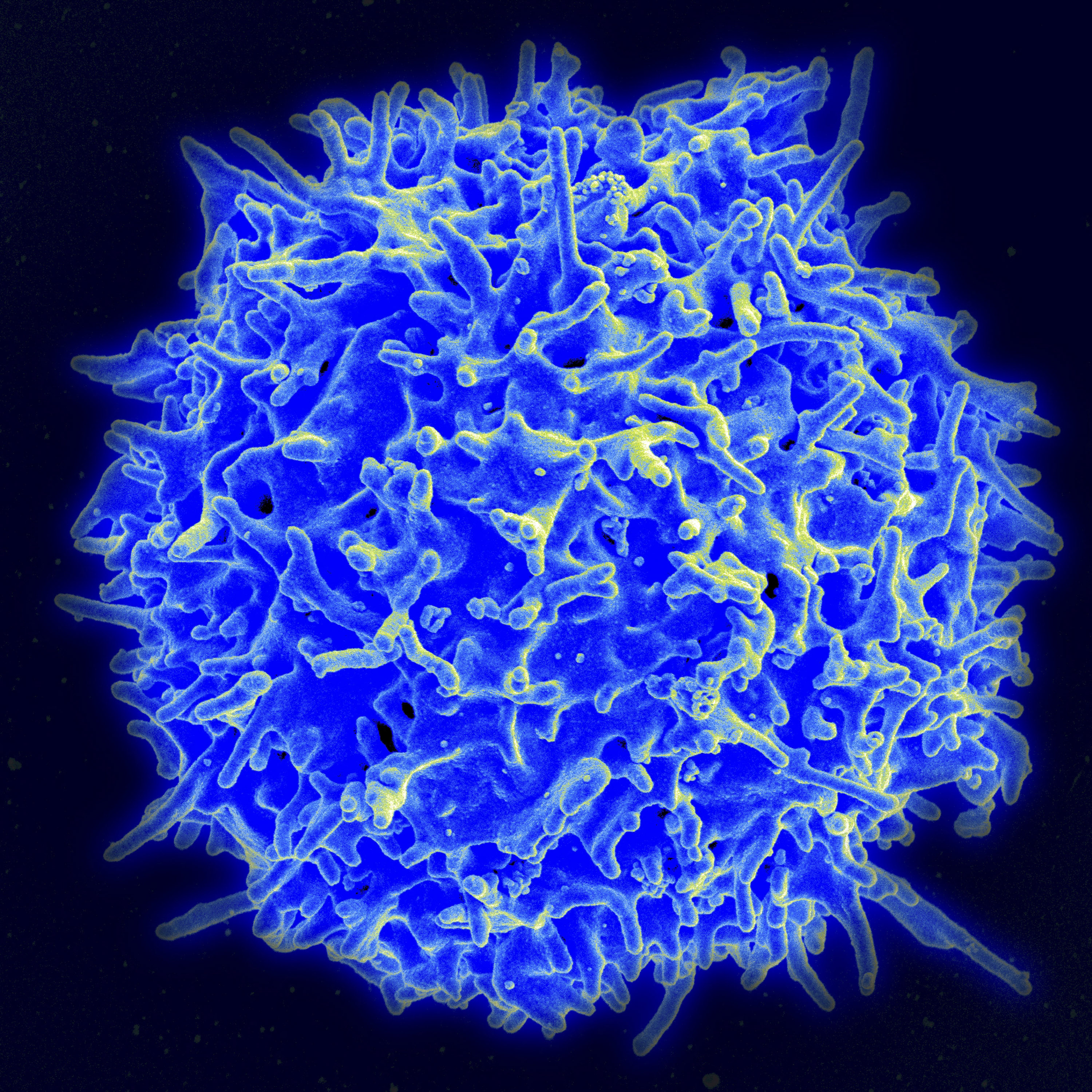 Egészséges emberi T-sejt elektronmikroszkópos portréje
