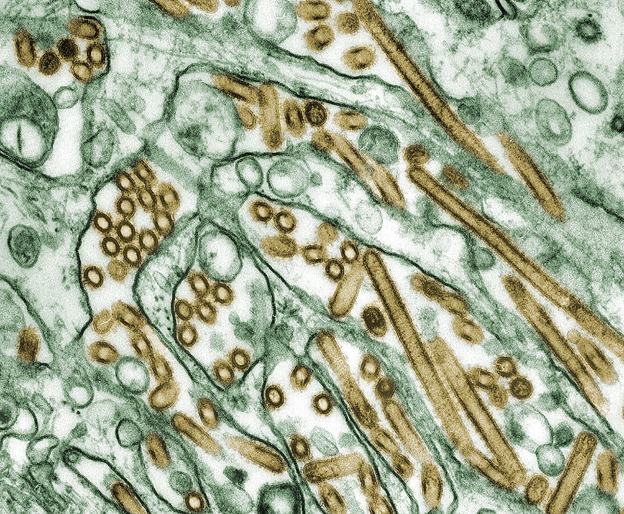 Már az amerikai járványügy is figyelemmel kíséri a H5N6 madárinfluenza-vírus által okozott kínai megbetegedéseket