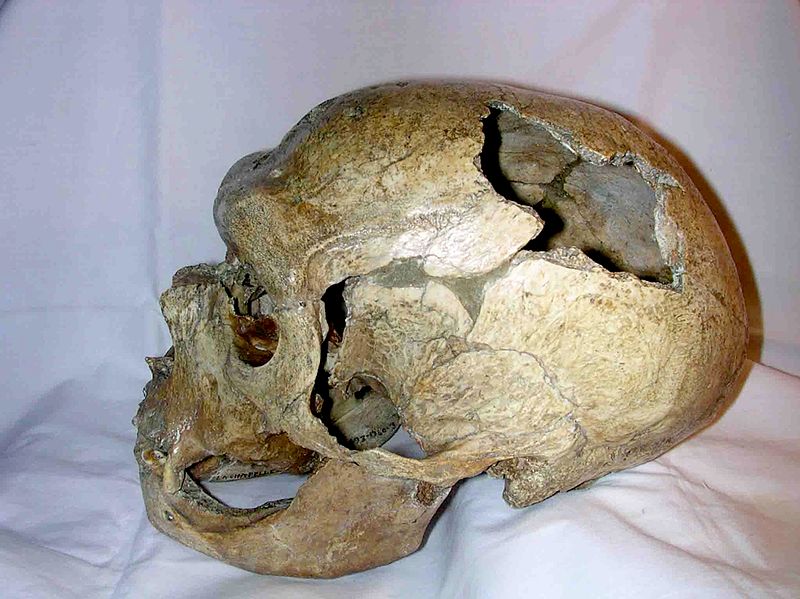 Állatról emberre terjedő kór okozhatta egy neandervölgyi halálát
