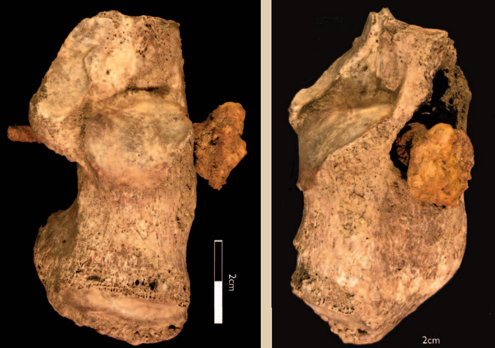Egy 1900 éves csontváz sarkában talált szög bizonyítja a római keresztre feszítéseket