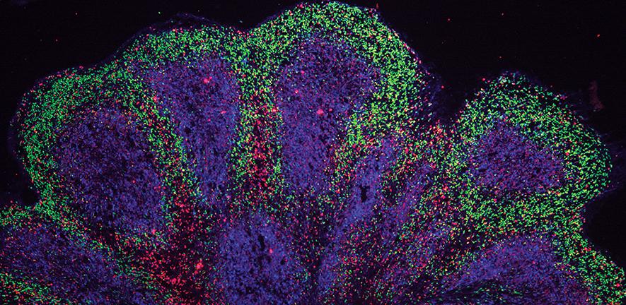 Magyar kutatók őssejtekből növesztett miniagyakkal vizsgálják a neurodegeneratív betegségeket