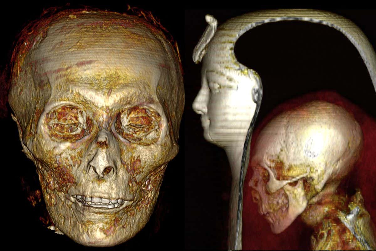 I. Amenhotep koponyája és elhelyezkedése a szarkofágban