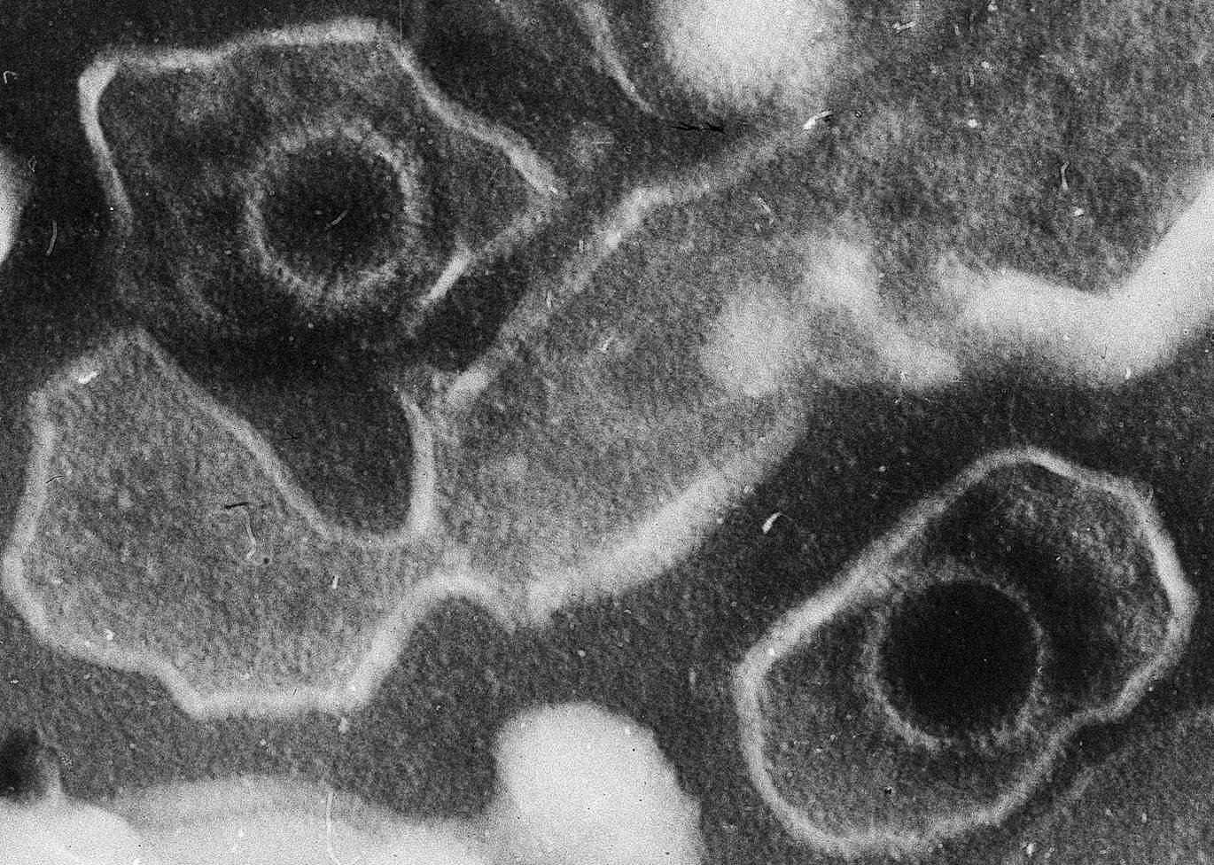 Két Epstein-Barr vírusrészecske (bal fent, jobb lent) egy elektronmikroszkópos felvételen