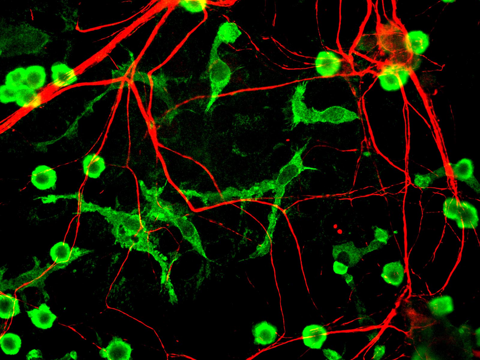 Zöld mikroglia sejtek piros neuronok hálójában