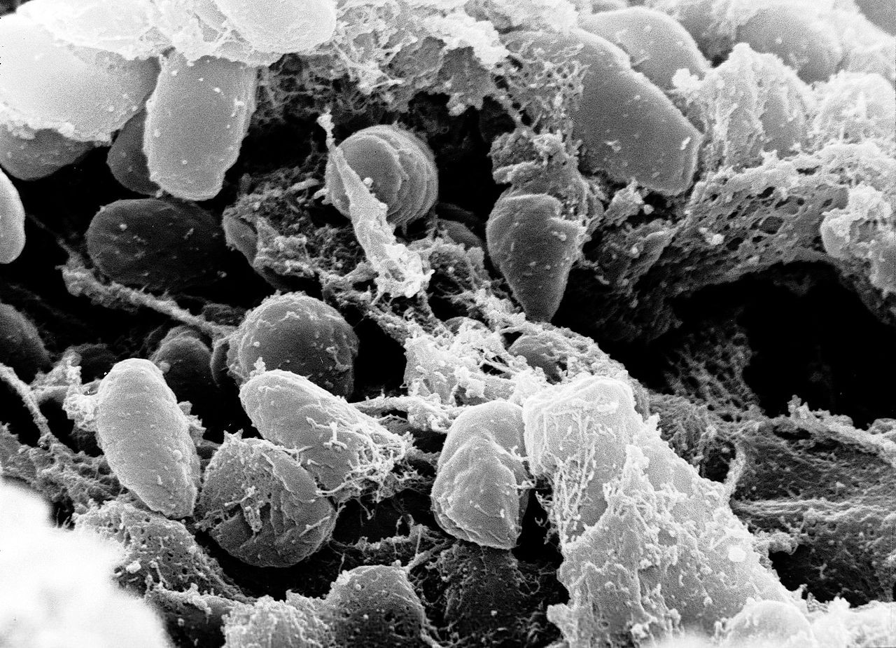A Yersinia pestis baktérium pásztázó elektronmikroszkópos felvételen