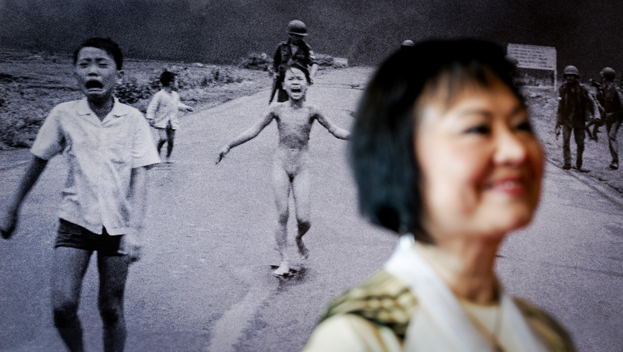 Megkapta utolsó bőrkezelését a világ egyik leghíresebb fényképén szereplő "napalm lány"