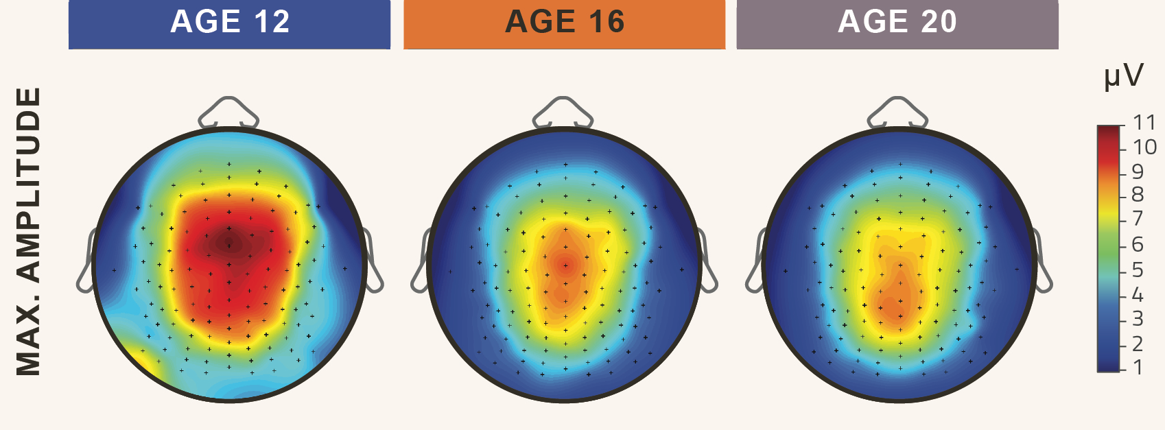 Teljes alvási EEG-aktivitás 12, 16 és 20 éveseknél