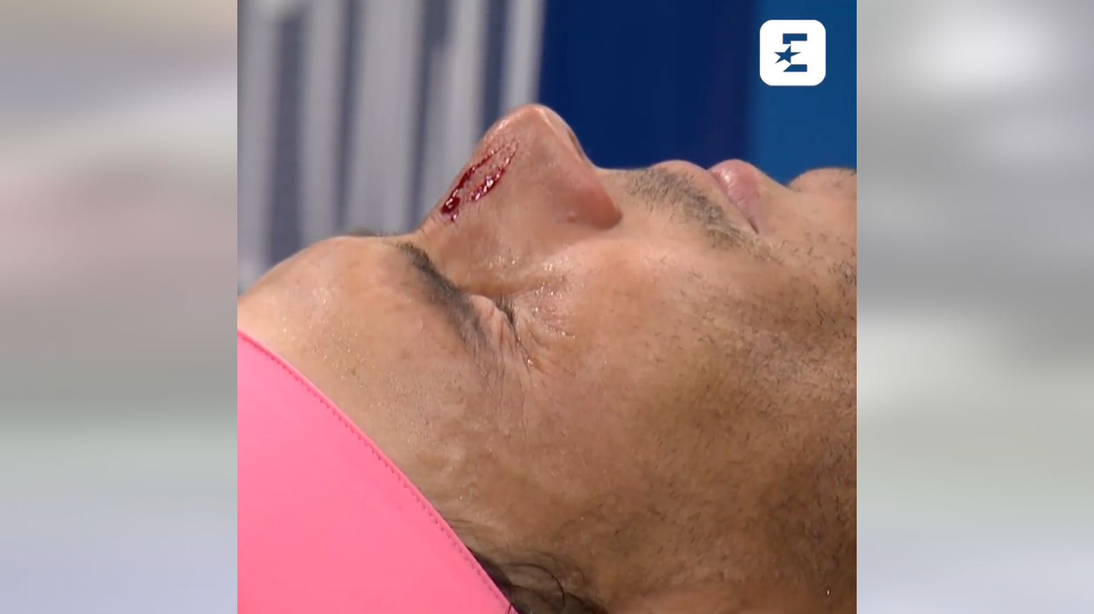 A világklasszis Rafael Nadal kőkeményen orrba verte magát a saját ütőjével, percekig kellett ápolni az eset után