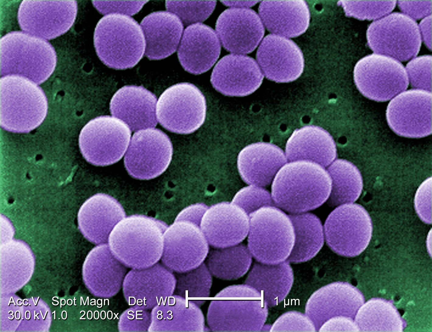 Magyar kutató mutatta ki, hogy az antibiotikumkoktéloknál hatásosabbak a szelektíven ható mikrobiális szerek
