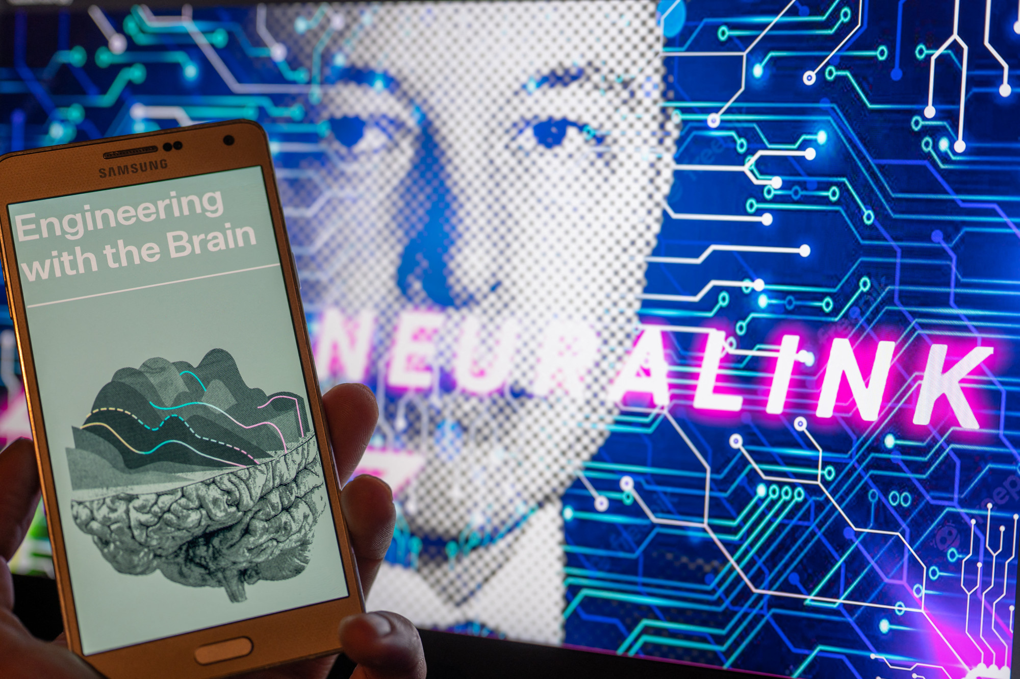 Elon Musk cége engedélyt kapott arra, hogy chipet ültessen emberek agyába