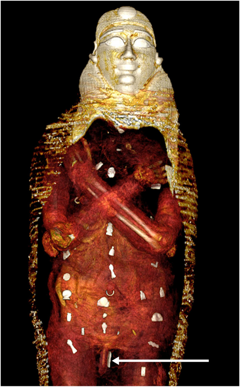 49 nagy értékű védelmező amulettel temették el a kb. 14-15 éves, feltehetően nem egyiptomi, de Egyiptomban elhunyt fiút nagyjából 2300 éve.