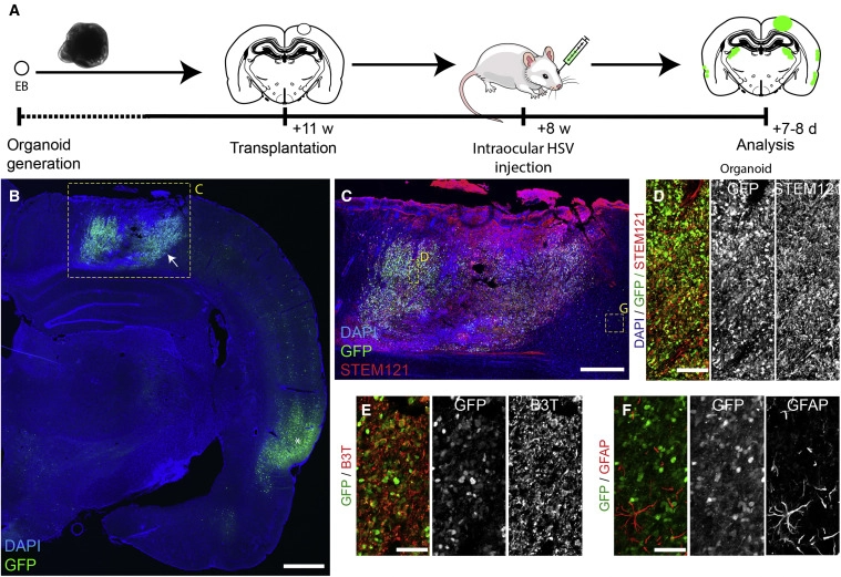 Emberi idegsejteket ültettek patkányok agyába, és sikerült is neuronválaszt elérni