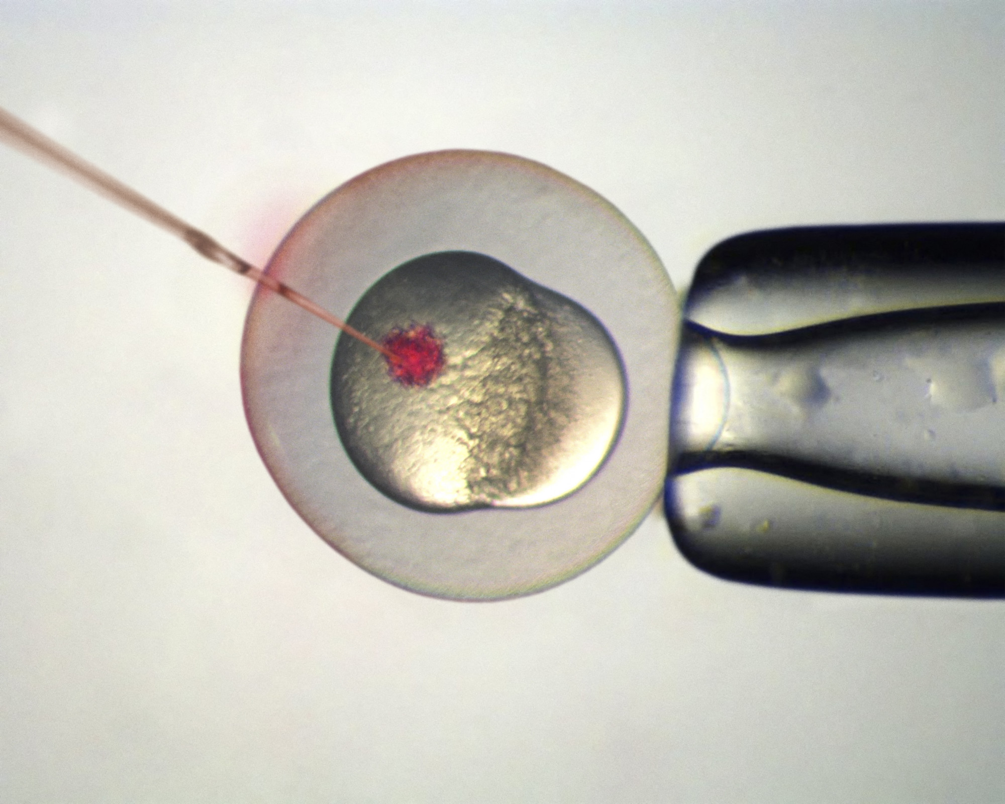 Szintetikus embriókat hoztak létre pusztán őssejtekből egy áttörő kutatásban