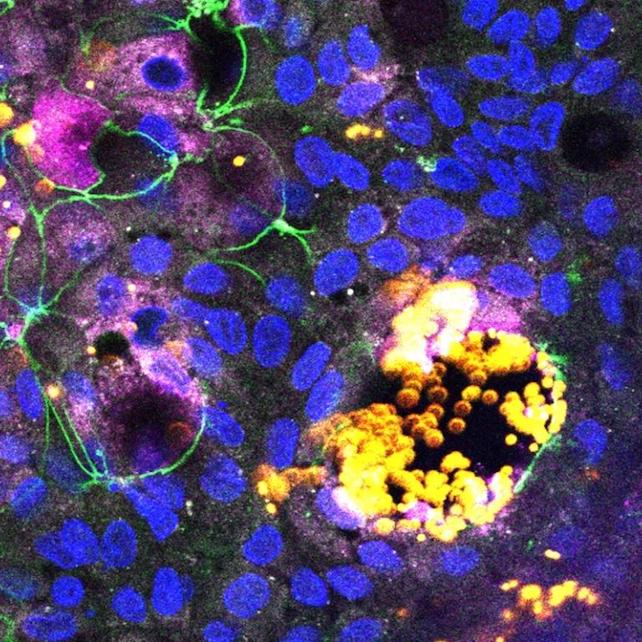 Sárga mikroműanyag-szennyezés az emberi bélorganoid szöveti sejtjeiben