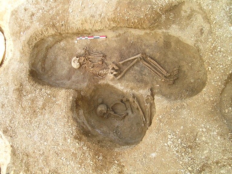A női csontváz és a mellé hordott csontok