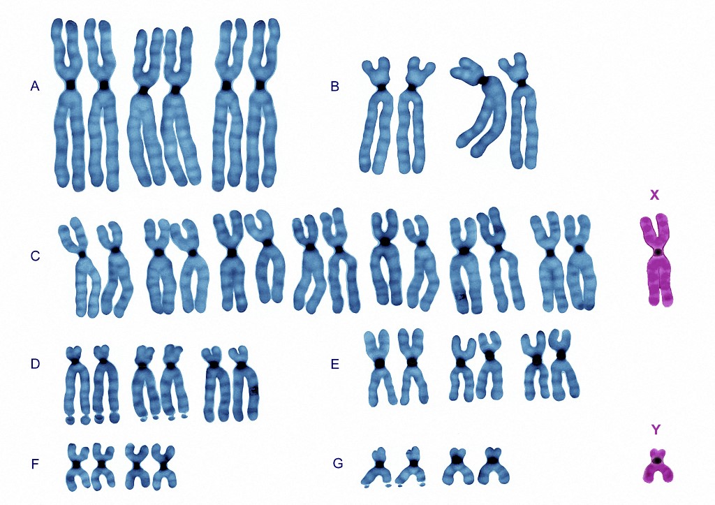 Egy férfi normál kromoszómakészlete 22 pár testi és 1 pár ivari kromoszómával