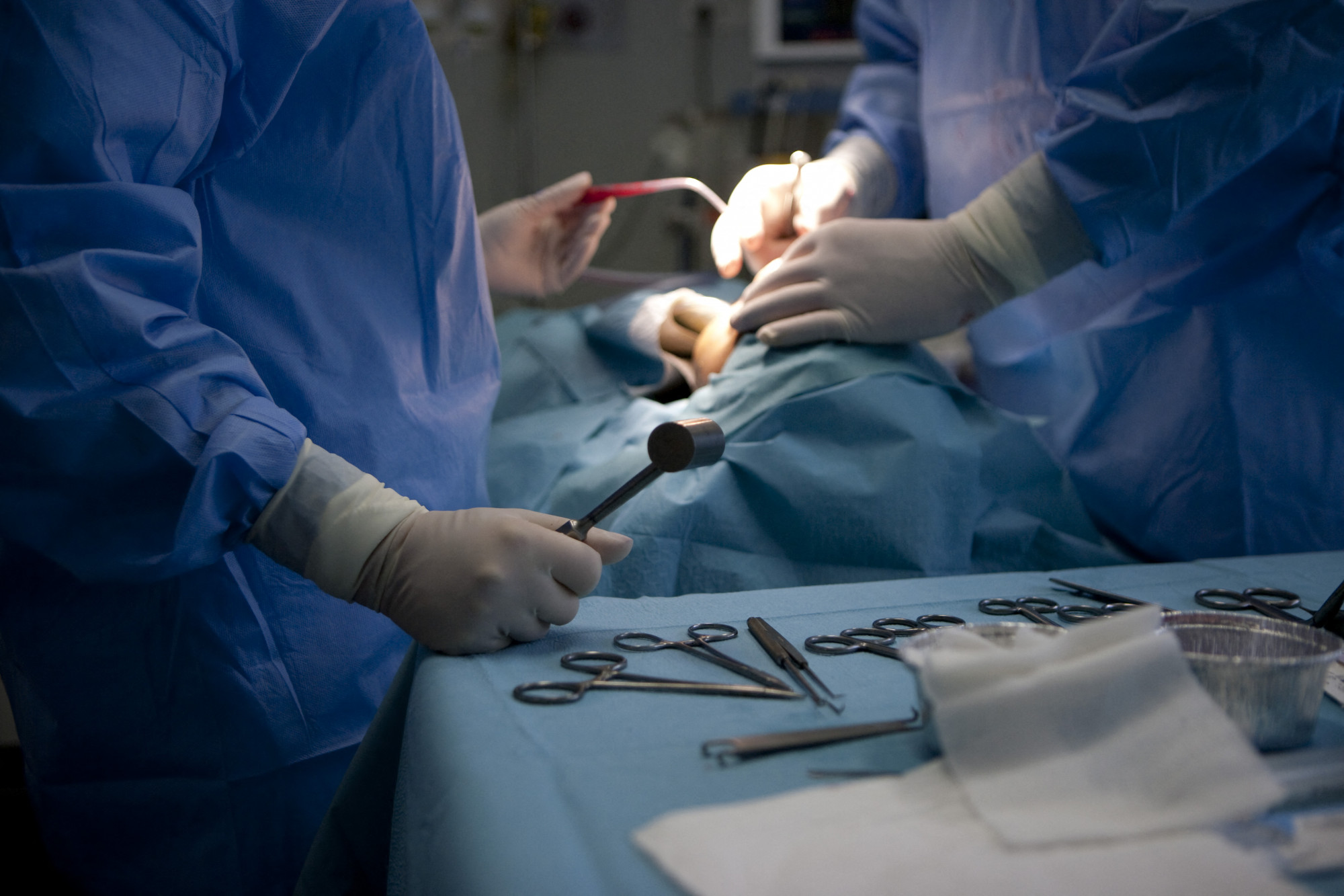 Kevesebb komplikáció várható a női sebészek által operált betegek körében